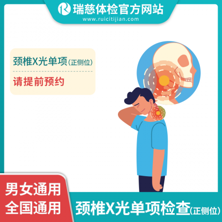 颈椎X光正侧位单项卡